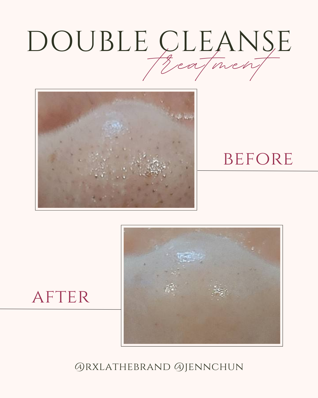 Struggling with Skin Texture and Brightness? Double Cleansing Will Help