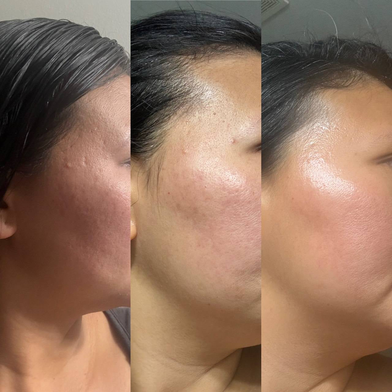 I'm on a Journey to Glass Skin, So I Tried These Viral Korean Skincare Products and I'm Hooked